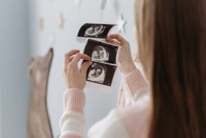 כל מה שצריך לדעת בתחילת ההיריון